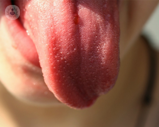 Trastornos de la lengua
