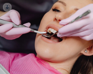 rehabilitacion implantes dentales tipos procedimiento