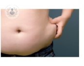 Abdominoplastia, cirugía para remodelar el abdomen