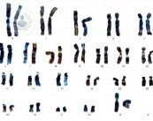 Mapa genético cromosomas diagnostico genetico preimplantacional