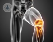 Un recambio de prótesis se hace cuando una prótesis implantada está dañada