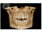 Descubre los beneficios de la tecnología 3D en Odontología.