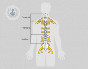 medula espinal: sintomas medula anclada