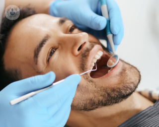 cuidados tras implantes dentales