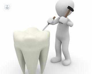 endodoncia diente