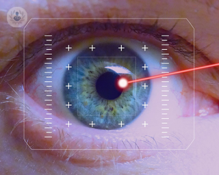 cirugia refractiva laser