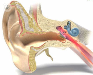 La hipoacusia es la pérdida parcial de la audición. Puede afectar al oído medio, al oído interno o a ambos. En función del tipo de hipoacusia el nivel de sordera será mayor.