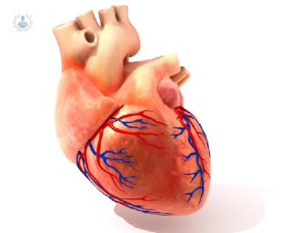 Dispositivo de terapia de resincronización cardíaca TRC