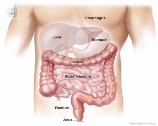 Nuevo diagnóstico del cáncer de colon
