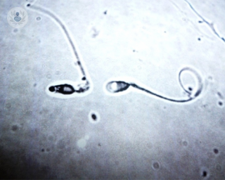 analisis espermatozoides
