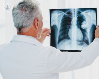 cirugia torácica de alta complejidad doctor radiografia top doctors