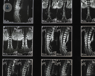 Las técnicas sobre artroscopia, endoscopia y mínimamente invasivas, las explica el Dr. Ricardo Casal en lesiones de cadera, cruzado anterior o hernia discal