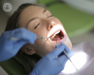 Cuidados implantes dentales