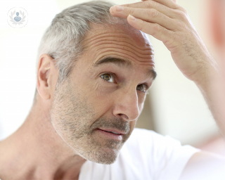 hombre calvo espejo topdoctors alopecia