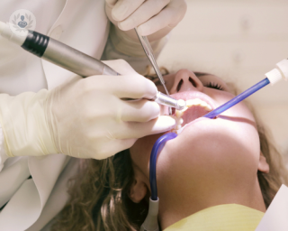 Postoperatorio implantes dentales