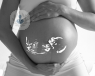 control_prenatal_odontologico_embarazo_feto_madre