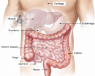 La endoscopia digestiva permite el diagnóstico de enfermedades digestivas