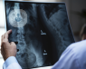 vetebras radiografia medico top doctors 
