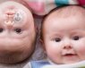Los embarazos de gemelos han aumentado por las técnicas de reproducción asistida y retraso de la maternidad. La Dra. de Paco te informa