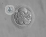 Embriones humanos
