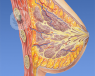 Las mamas tuberosas son un tipo de malformación que afecta a las mujeres en su etapa adolescente 