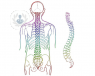 Qué son las malformaciones vasculares espinales