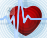 dispositivos intracardiacos