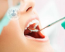 El edentulismo o carencia total o parcial de los dientes afecta al día a día del paciente