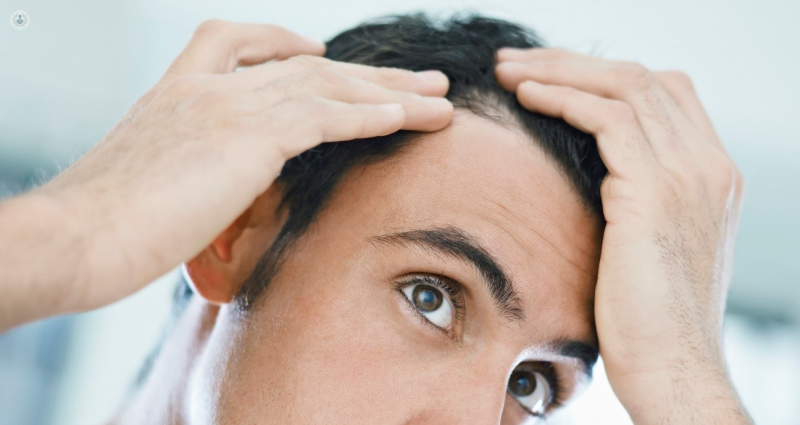 PRP caida del cabello y alopecia | Top Doctors