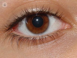 chirurgia refrattiva laser utilizzato per correggere i difetti di rifrazione negli occhi