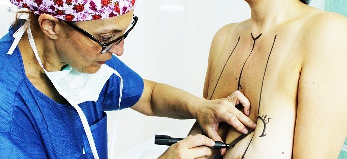 breast augmentation and augmentation