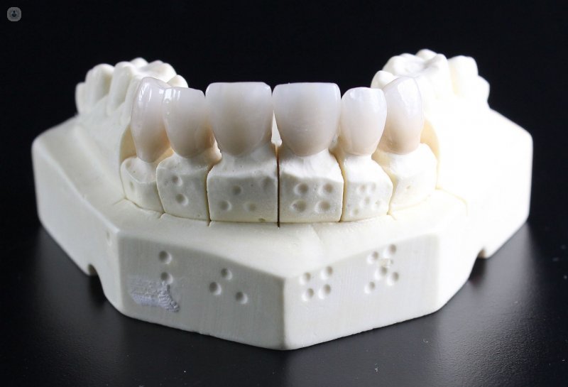 Pótesis dentales