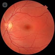 mácula de la retina