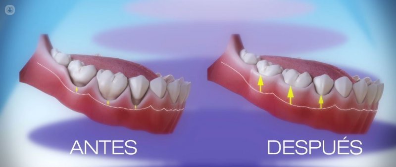 Smile periodontics