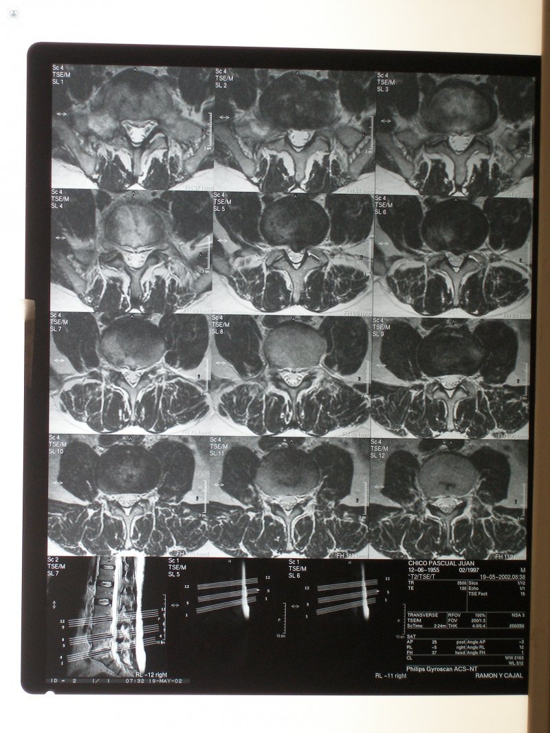 radiology lumbago