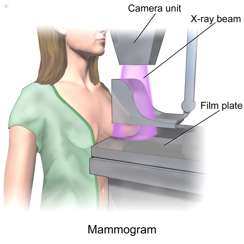 prueba mamaria