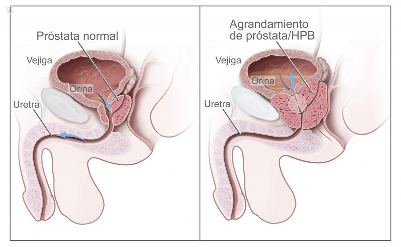 prostata drawing