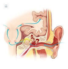 parti della perdita di udito all'orecchio