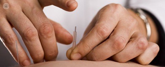 La punción seca introduce pequeñas agujas en las zonas lesionadas