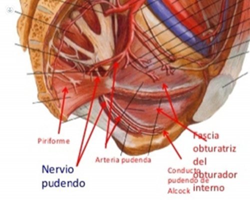 pudendal neuralgia profile