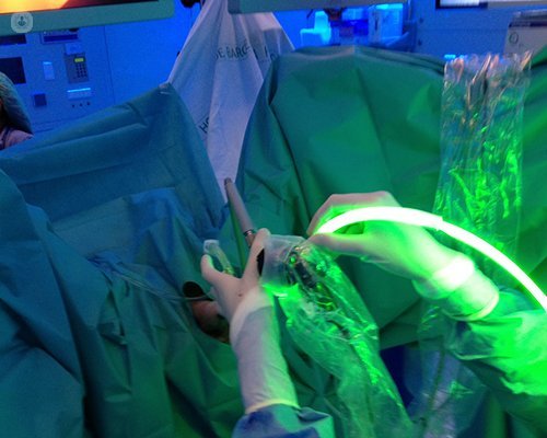 trattamento laser verde