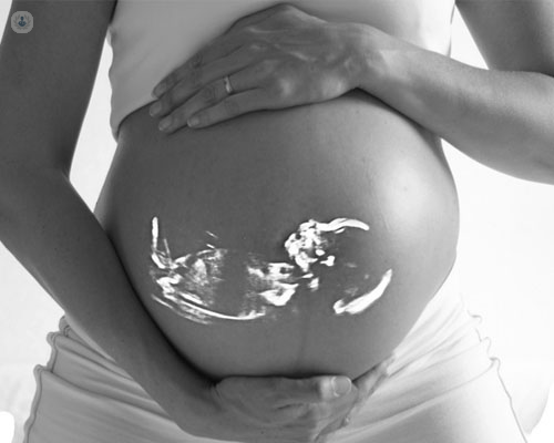 El hecho de posponer la maternidad influye considerablemente en la posibilidad de concebir - Top Doctors
