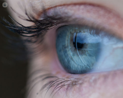 ojo con glaucoma | Top Doctors