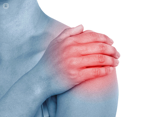 Artritis de hombro | Top Doctors
