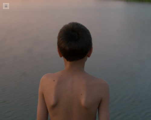 Foto de la espalda de un niño - problemas de espalda en niños - escoliosis - by Top Doctors