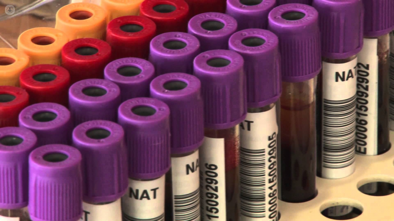 Primer plano de unos tubos de muestras de sangre - enfermedades de la sangre | By Top Doctors