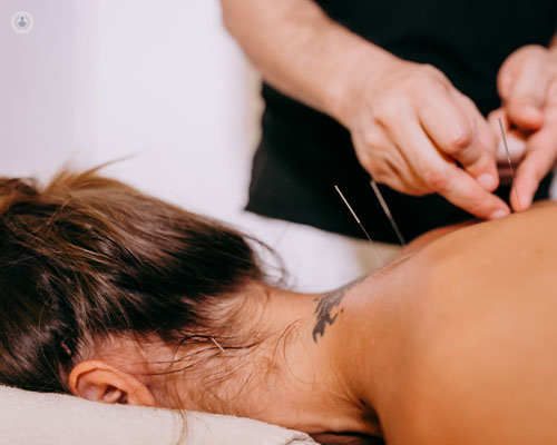 La acupuntura es una técnica tradicional de la medicina china que se basa en el uso de agujas para tratar problemas específicos