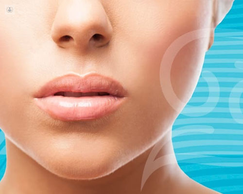 Primer plano del rostro de una mujer con aumento de labios - ácido hialurónico - by Top Doctors