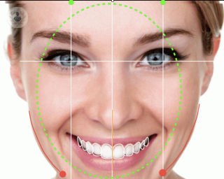 Diseño de sonrisa digital rostro