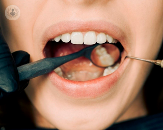 La maloclusión es una afección dental que puede afectar en distintas etapas de la vida.